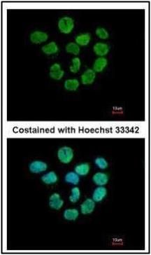 Histone H2A.Z Rabbit Polyclonal Antibody