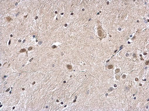 Histone H2A.Z Rabbit Polyclonal Antibody