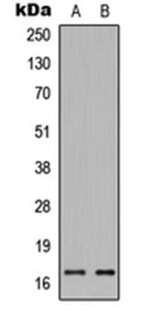 Histone H3 (phospho-S28) antibody