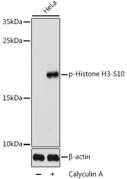 Histone H3 (Phospho-S10) antibody