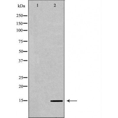 Histone H3K36me2 antibody