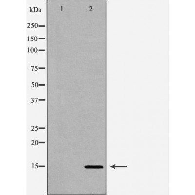 Histone H3R2me2s antibody