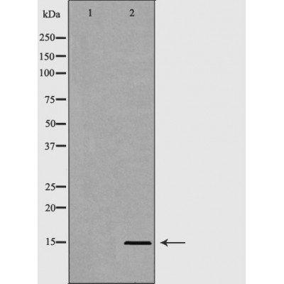 Histone H3R8me2s antibody