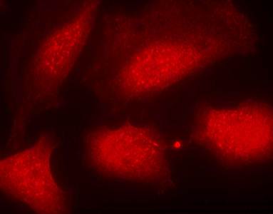 Histone H3.1 (Phospho-Ser10) Antibody