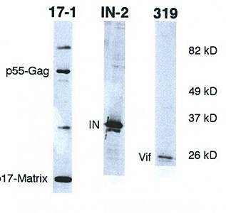 HIV1 P17 Gag antibody