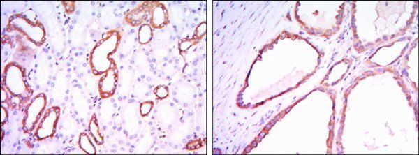 HK1 Antibody