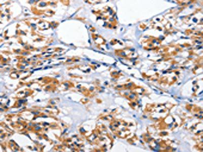 HK2 Antibody