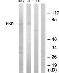 HKR1 antibody