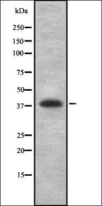 HLA-B antibody