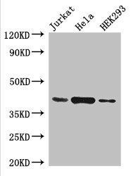 HLA-C Antibody