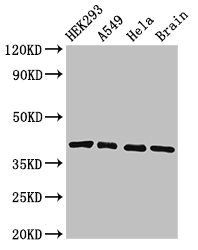 HLA-C Antibody