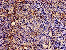 HLA-C Antibody