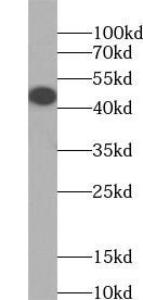 HLA class I (HLA-A) antibody