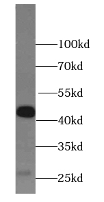 HLA class I (HLA-B) antibody