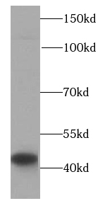 HLA class I (HLA-C) antibody