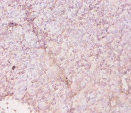 HLA-DRA Antibody