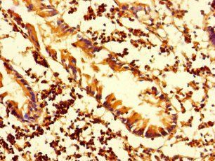 HLA-DMA Antibody