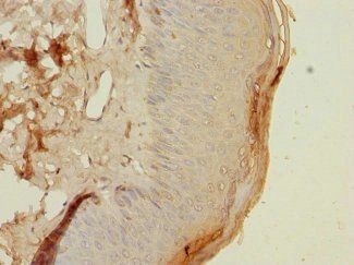 HLA-DOA Antibody