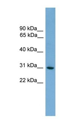HLA-DQA2 antibody