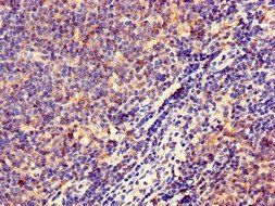 HLA-DQB1 Antibody
