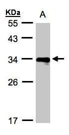 HLA-DR beta antibody