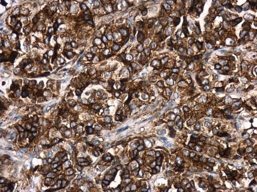 HLA-DR antibody [N2C3]