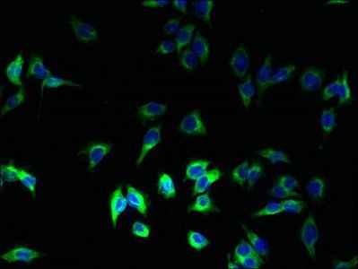 HLA-DRB1 Antibody