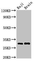 HLA-DRB3 antibody