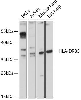 HLA-DRB5 antibody