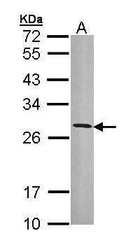 HLA-DRB3 antibody