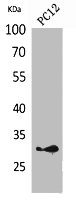 HLA-DQB1 antibody