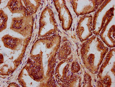 HLCS Antibody