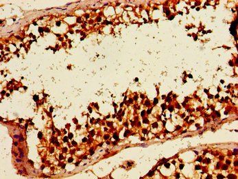 HLTF antibody