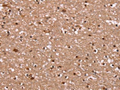 HLTF Antibody