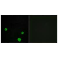 HLX Antibody