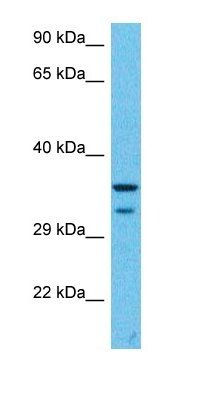 HM20B antibody