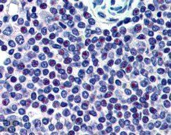 Goat anti-HMG20A Antibody