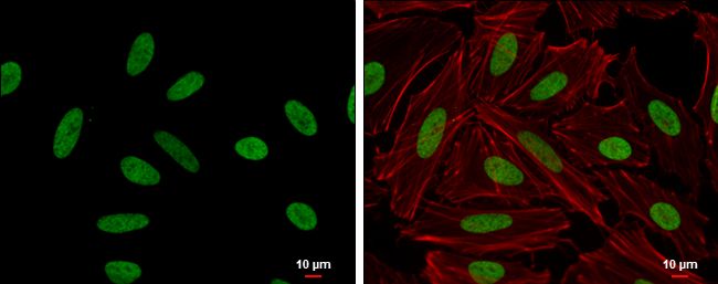 HMGA2 antibody - ChIP grade