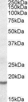 Goat anti-HMGI-C / HMGA2 Antibody