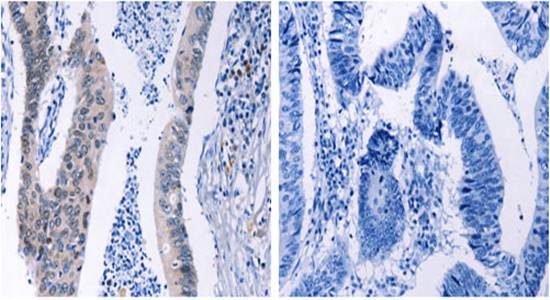 HMGB3 Antibody