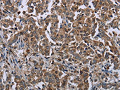 HMGCR Antibody