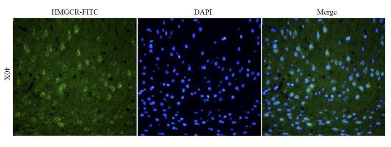 HMGCR (phospho-Ser872) antibody (FITC)