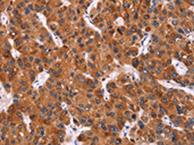 HMGCS2 Antibody
