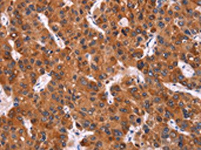 HMGCS2 antibody