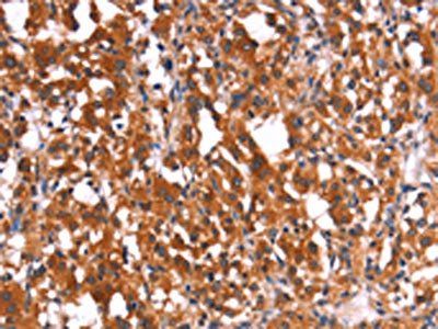 HMGCS2 Antibody