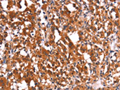 HMGCS2 antibody