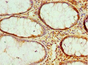 HMGN2 Antibody