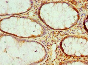 HMGN2 antibody