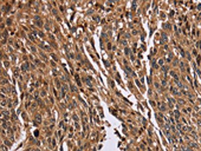 HMGN5 Antibody