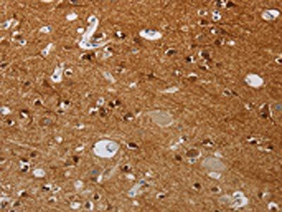 HMGN5 Antibody